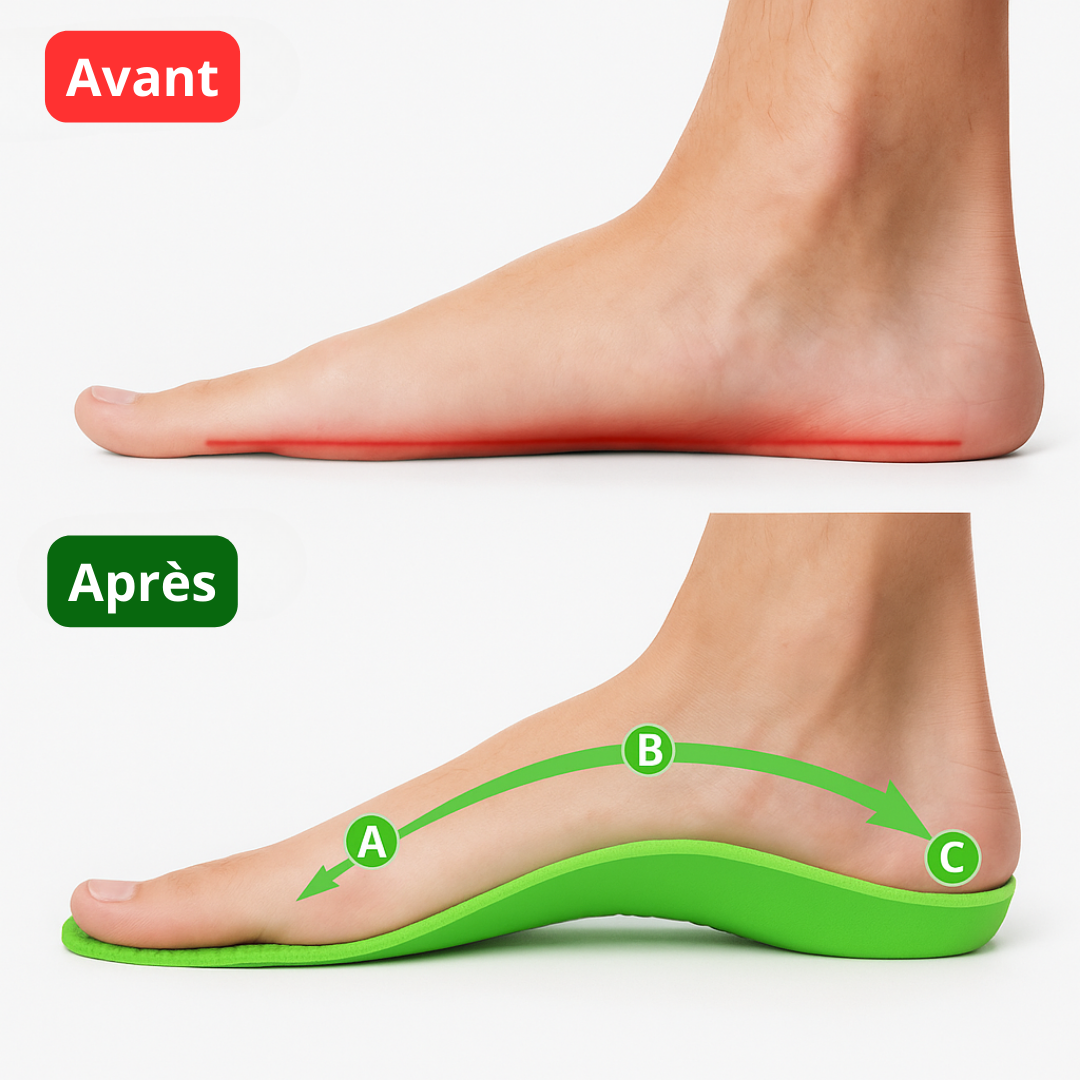 OrthoFlex — Semelles pour la Fasciite Plantaire